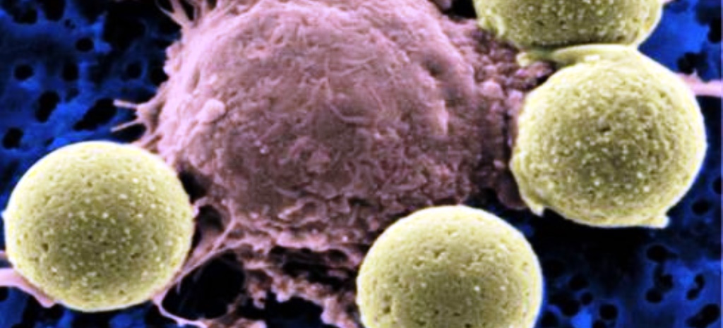 [Image: cancer-cell.jpg]