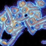 This is a micrograph of the Marburg virus. Credit: The University of Texas Medical Branch at Galveston