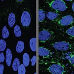 Human placental cells (blue) infected with Zika virus (green) responded to the malaria drug chloroquine (left). The drug prevented the virus from growing, unlike the drug rapamycin, which prompted the virus to grow rapidly (right). Studying pregnant mice, researchers at Washington University School of Medicine in St. Louis found that Zika virus manipulates the body’s normal barrier to infection, and that hydroxychloroquine, a malaria drug related to chloroquine, interferes with this process, protecting the fetus from viral infection. Credit: Washington University School of Medicine in St Louis
