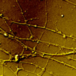 Axons, like those pictured above, are the so-called highways of the nervous system, which the herpes virus traffics to establish lifelong infection in a host. Photo by Laura Ruhge.