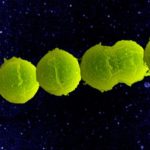 Group B Streptococcus. Credit: NIAID