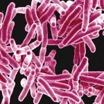 Mycobacterium tuberculosis Bacteria, the Cause of TB. Credit: NIAID