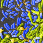 Some species of Vibrio bacteria (blue) can cause cholera in humans. A version of Vibrio cholerae designed to be harmless may one day protect people against the dangerous form of the bacteria. Credit: Tina Carvalho, University of Hawaii at Manoa