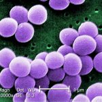 Under a very high magnification of 20,000x, this scanning electron micrograph (SEM) shows a strain of Staphylococcus aureus bacteria taken from a vancomycin intermediate resistant culture. Credit: CDC/ Matthew J. Arduino, DRPH / Photo: Janice Haney Carr