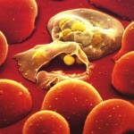 New study finds rise in global malaria R&D funds leads to largest ever pipeline