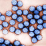 Rotavirus vaccination leads to large decreases in health care costs and doctor visit