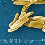 TB vaccine candidate shows early promise