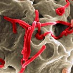 Scanning electron micrograph of Ebola virus. Image by NIAID