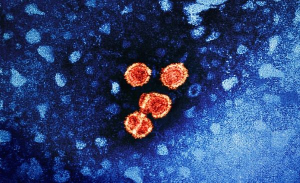 Hepatitis B Virus Colorized transmission electron micrograph of hepatitis B virus particles (colorized red and yellow). Credit: NIAID and CDC (Transmission electron micrograph image courtesy of CDC; colorization by NIAID).