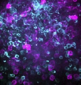 After exposing the lymphoid organ-chips to viral proteins, activated T cells (purple) and B cells (blue) cluster together to promote antibody production, just as they do in real lymphoid organs. CREDIT © 2024 Jeger-Madiot et al. Originally published in Journal of Experimental Medicine. https://doi.org/10.1084/jem.20240289