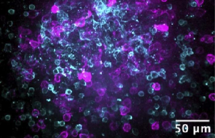 After exposing the lymphoid organ-chips to viral proteins, activated T cells (purple) and B cells (blue) cluster together to promote antibody production, just as they do in real lymphoid organs. CREDIT © 2024 Jeger-Madiot et al. Originally published in Journal of Experimental Medicine. https://doi.org/10.1084/jem.20240289