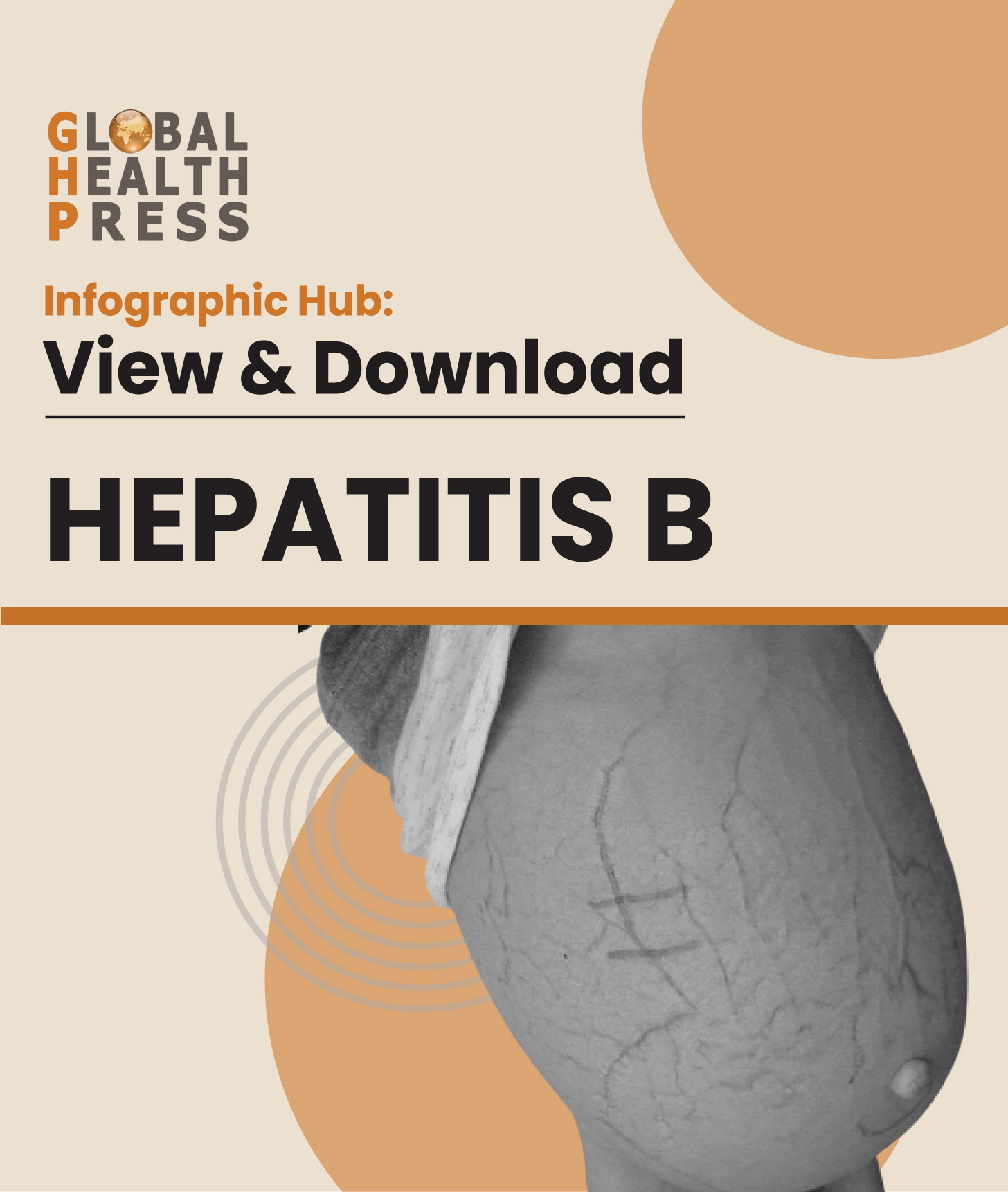 Hepatitis B Infographic