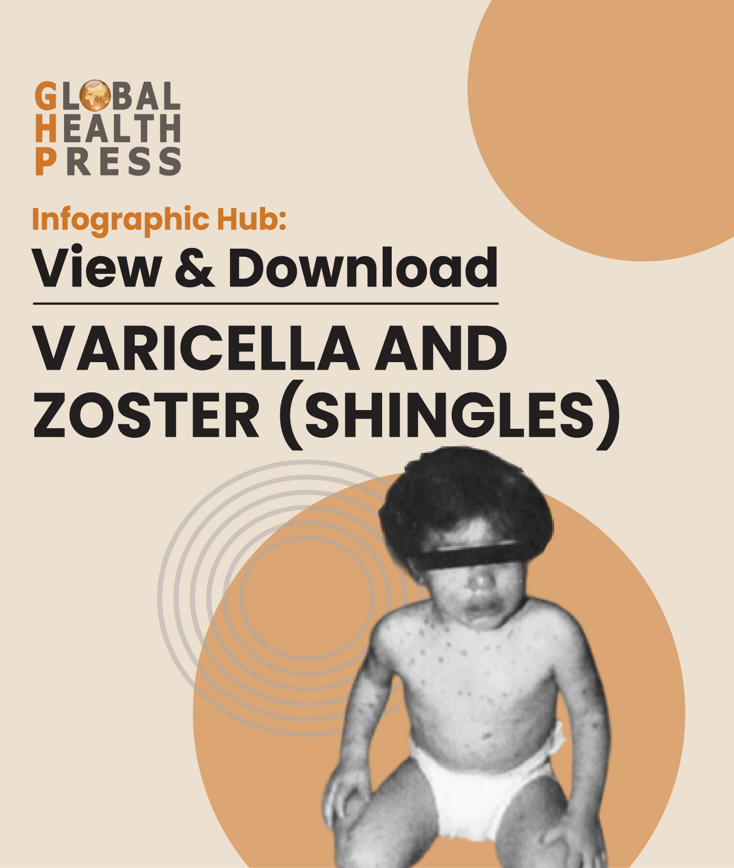 Vaccine Types Infographic